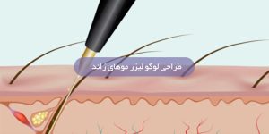 طراحی لوگو لیزر موهای زائد