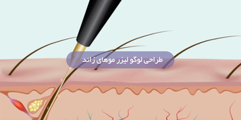 طراحی لوگو لیزر موهای زائد
